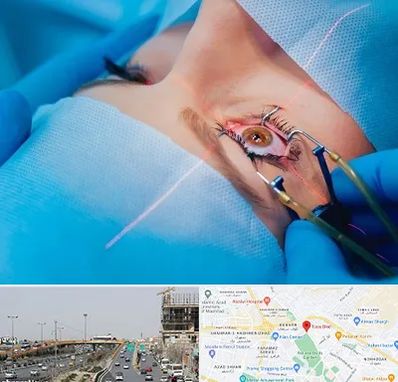عمل prk چشم در بلوار توس مشهد 