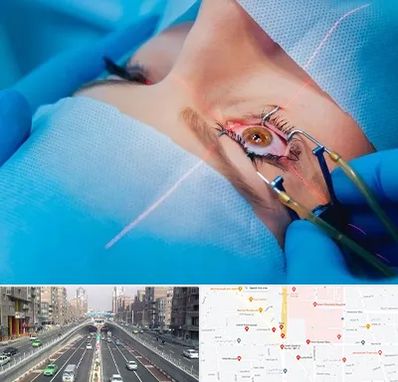 عمل prk چشم در توحید 