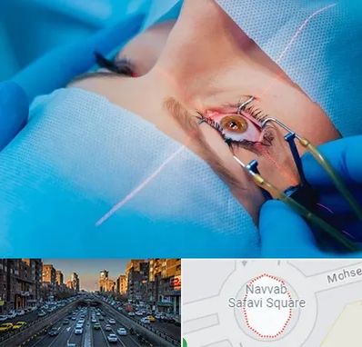 عمل prk چشم در نواب