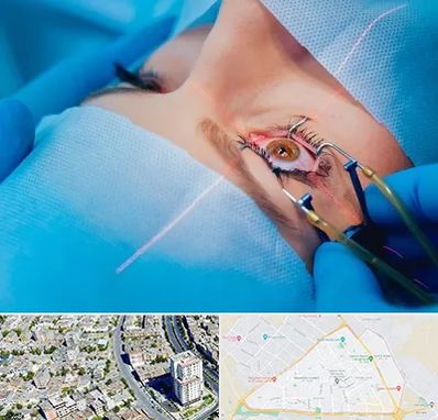 عمل prk چشم در قاسم آباد مشهد 