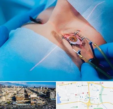 عمل prk چشم در شهرک راه آهن