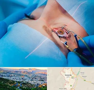 عمل prk چشم در سنندج