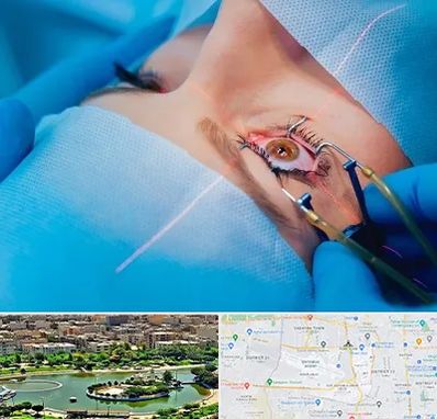 عمل prk چشم در منطقه 9 تهران 