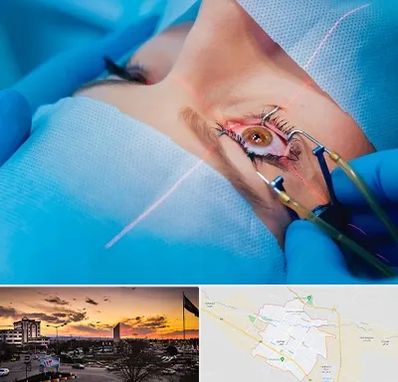 عمل prk چشم در قوچان