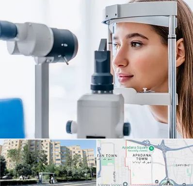 فوق تخصص شبکیه در آپادانا