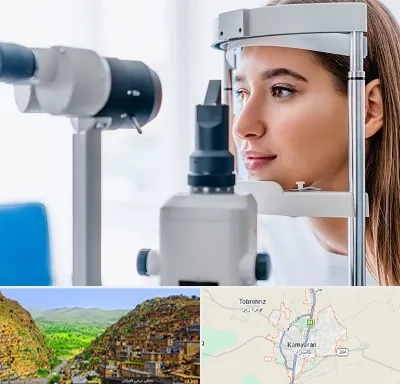 فوق تخصص شبکیه در کامیاران