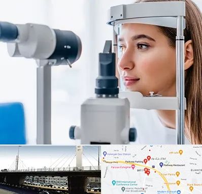 فوق تخصص شبکیه در پارک وی 