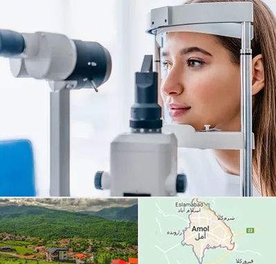 فوق تخصص شبکیه در آمل