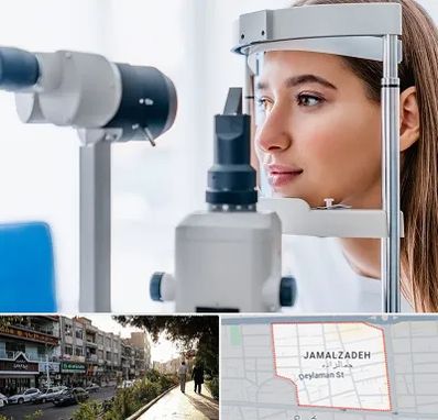 فوق تخصص شبکیه در خیابان جمالزاده