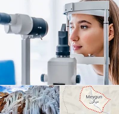 فوق تخصص شبکیه در میگون