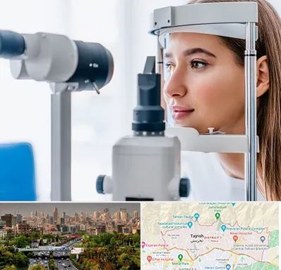 فوق تخصص شبکیه در منطقه 1 تهران 