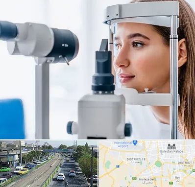 فوق تخصص شبکیه در جنوب تهران 