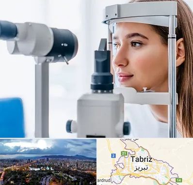 فوق تخصص شبکیه در تبریز