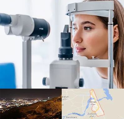 فوق تخصص شبکیه در میناب