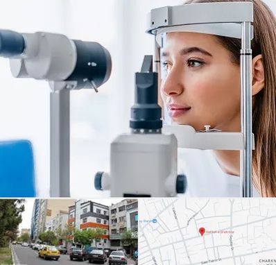 فوق تخصص شبکیه در هفده شهریور تبریز