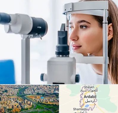 فوق تخصص شبکیه در اردبیل