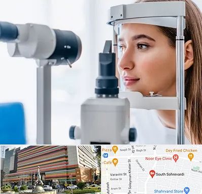 فوق تخصص شبکیه در سهروردی 