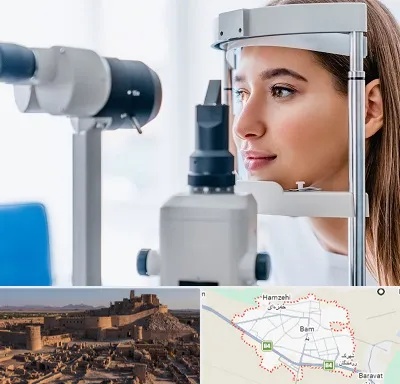 فوق تخصص شبکیه در بم