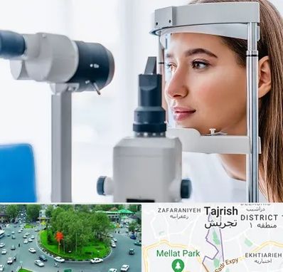 فوق تخصص شبکیه در تجریش 