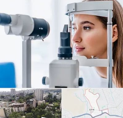 فوق تخصص شبکیه در اوین