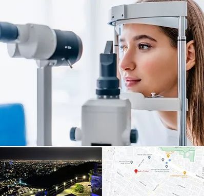 فوق تخصص شبکیه در هفت تیر مشهد 