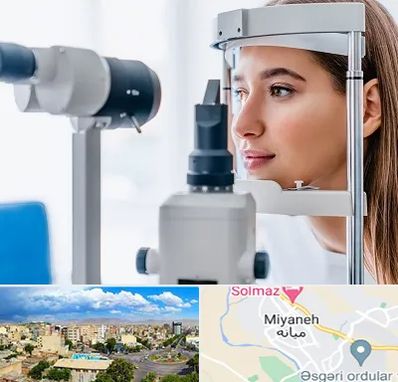 فوق تخصص شبکیه در میانه