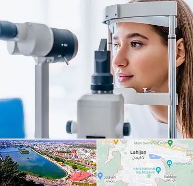 فوق تخصص شبکیه در لاهیجان