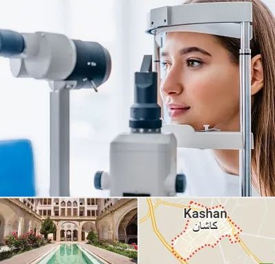 فوق تخصص شبکیه در کاشان