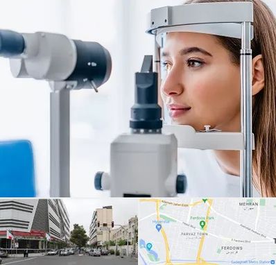 فوق تخصص شبکیه در بلوار فردوس 