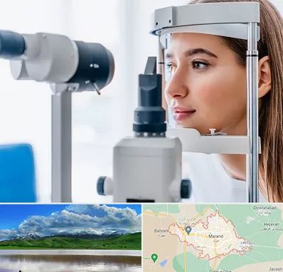 فوق تخصص شبکیه در مرند