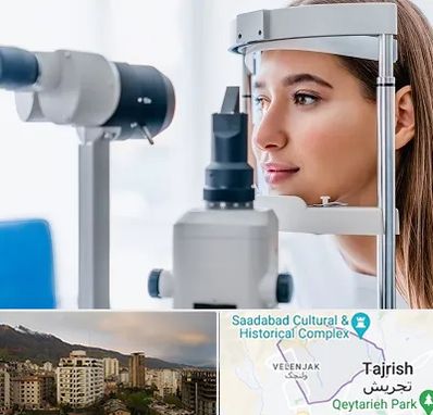 فوق تخصص شبکیه در زعفرانیه 