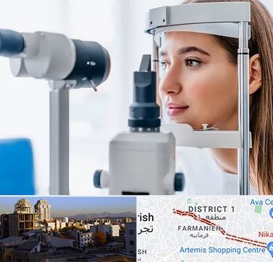 فوق تخصص شبکیه در فرمانیه 