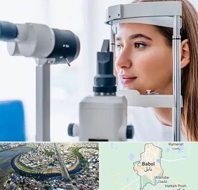 فوق تخصص شبکیه در بابل