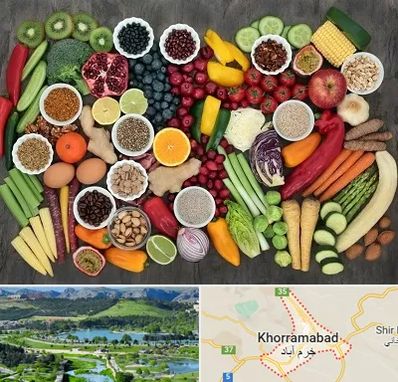 دکتر تغذیه برای چاقی در خرم آباد