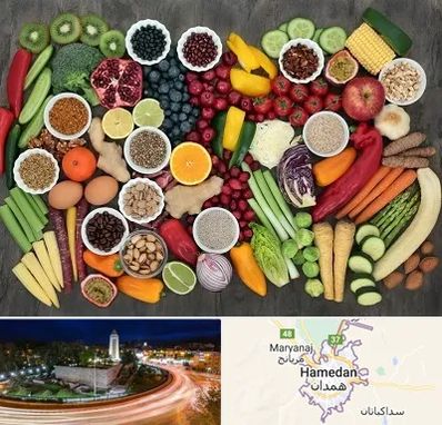 دکتر تغذیه برای چاقی در همدان