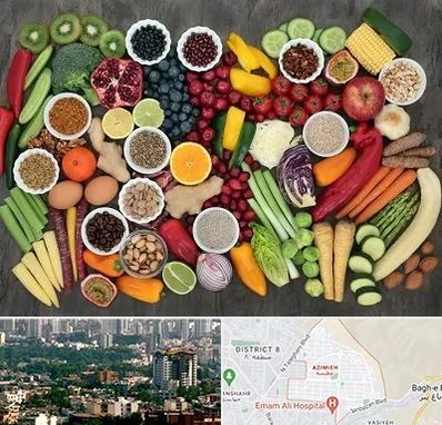 دکتر تغذیه برای چاقی در عظیمیه کرج 