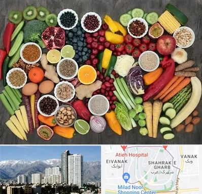 دکتر تغذیه برای چاقی در شهرک غرب 