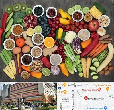 دکتر تغذیه برای چاقی در سهروردی 