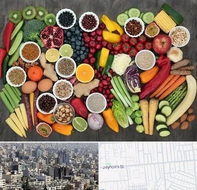 دکتر تغذیه برای چاقی در جیحون