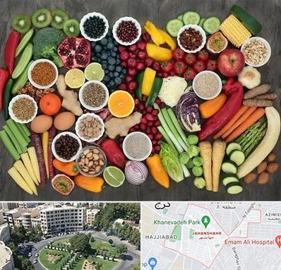 دکتر تغذیه برای چاقی در جهانشهر کرج 