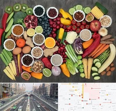 دکتر تغذیه برای چاقی در توحید 