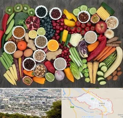 دکتر تغذیه برای چاقی در یاسوج