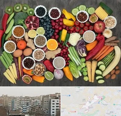 دکتر تغذیه برای چاقی در محمد شهر کرج 