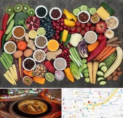 دکتر تغذیه برای چاقی در میدان ولیعصر 