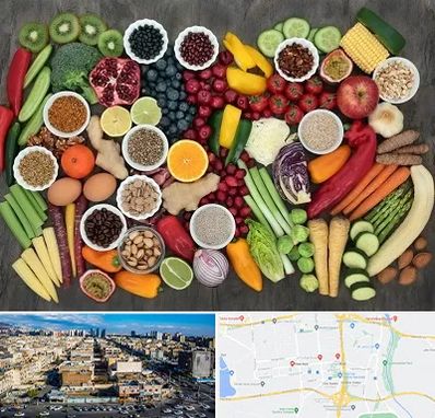 دکتر تغذیه برای چاقی در شهرک راه آهن