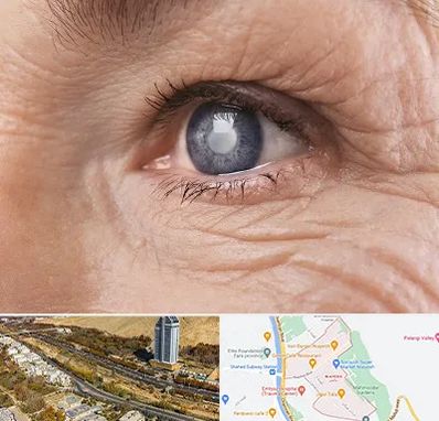 متخصص آب مروارید در خیابان نیایش شیراز