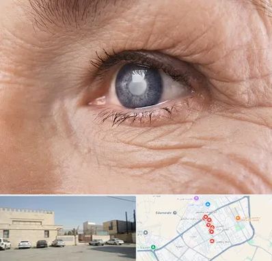 متخصص آب مروارید در نواب اسلامشهر