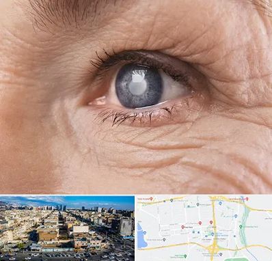 متخصص آب مروارید در شهرک راه آهن