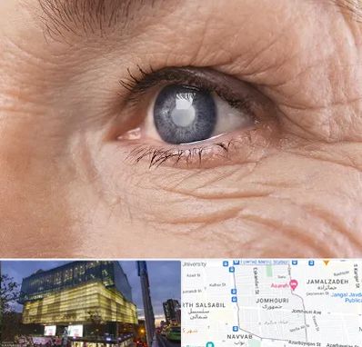 متخصص آب مروارید در جمهوری