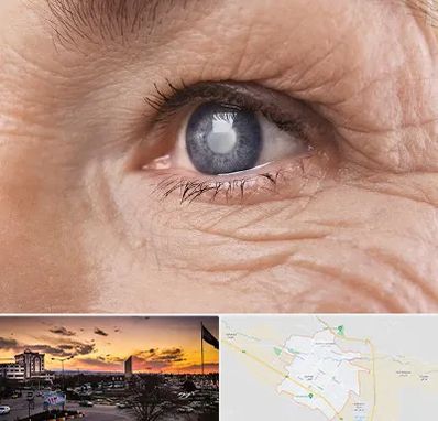 متخصص آب مروارید در قوچان